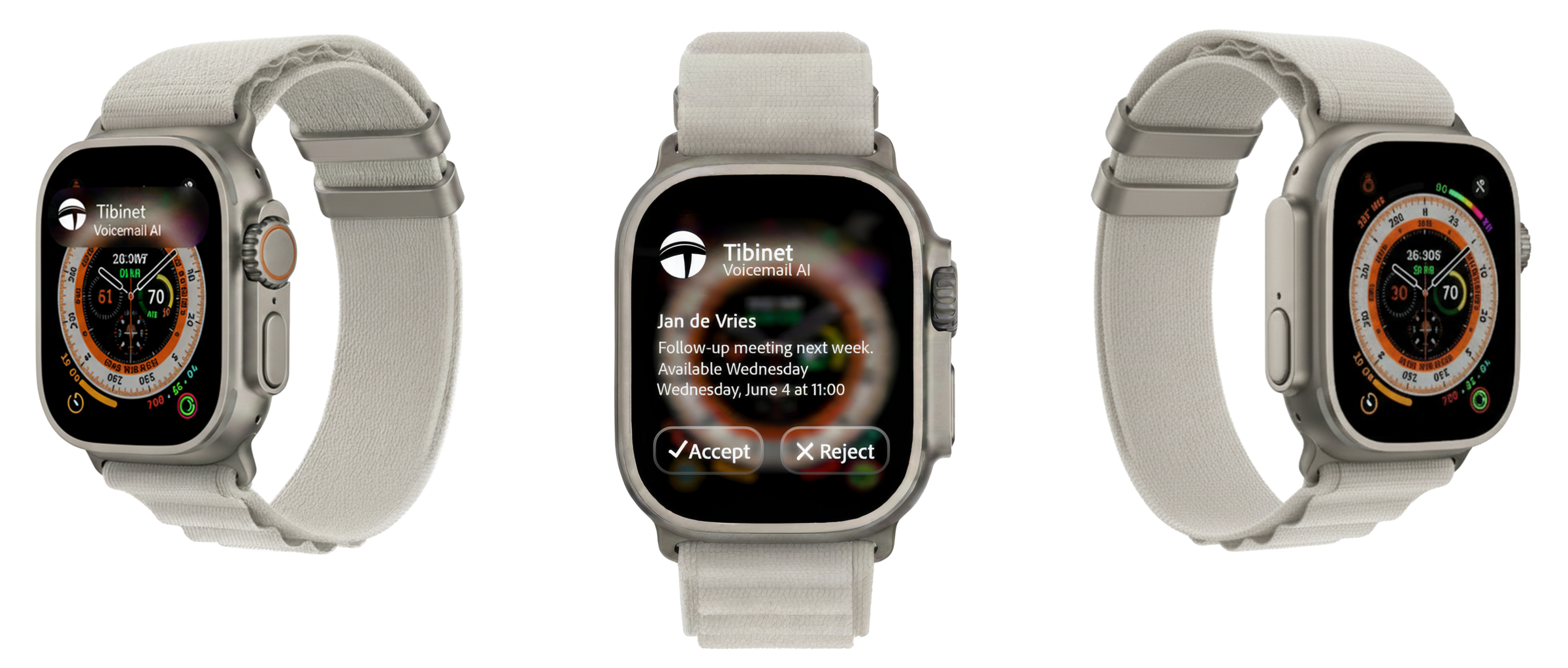 AI Voicemail interface